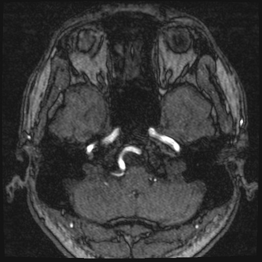 Click on the Serie image to view the images of VILLANUEVA, WILLIAM A.